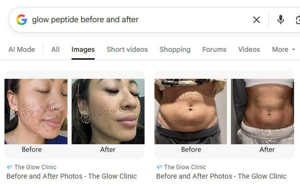 glow peptide before after search results